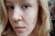 FactCheck: Were media reports that a 17-year-old Dutch rape victim was euthanised correct?