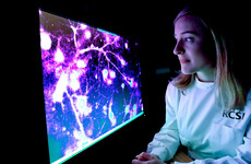 Irish researchers make discovery which may lead to epilepsy 'warning system'
