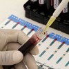 Blood tests may predict breast cancer spread
