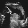 Unborn babies could be tested for 3500 genetic conditions