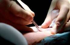 Medical graduates angered after HSE blunder sees internship offers rescinded