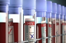 There have been over 470 new diagnoses of HIV in Ireland so far this year