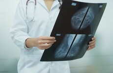 Artificial intelligence beats doctors in breast cancer diagnosis