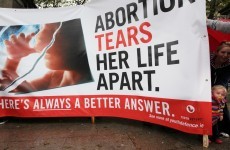 Column: These billboards simply bring the reality of abortion into focus