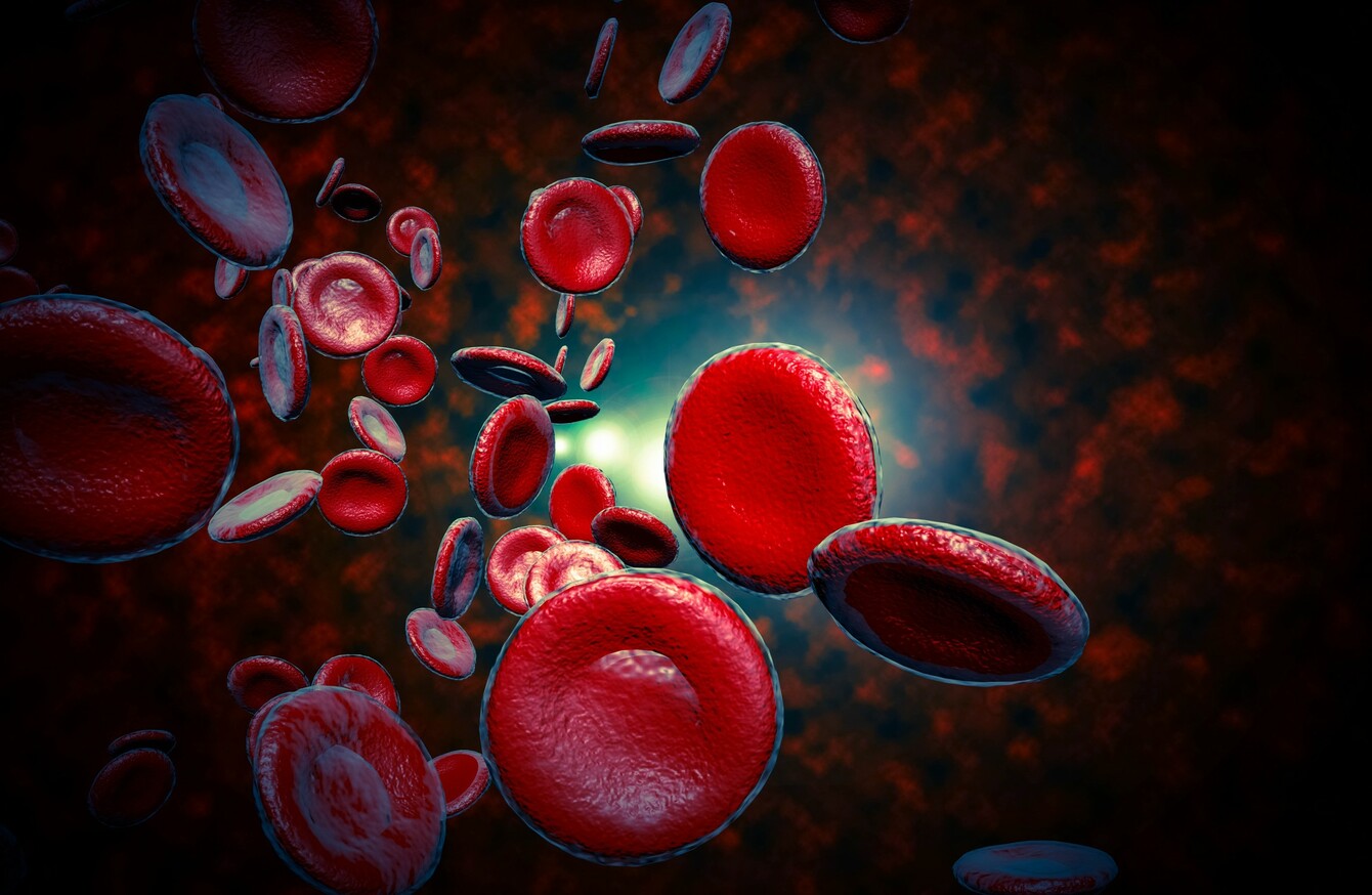 sepsis-linked-to-11m-deaths-worldwide-double-what-was-previously-thought