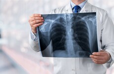 Concerns raised after Cork doctors, rather than radiographers, did x-rays on patients with coronavirus symptoms