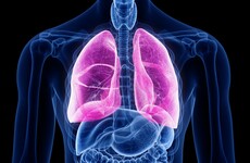Opinion: 'Covid-19 is the world's biggest fear. Welcome to my world.' Diary of a man with Cystic Fibrosis