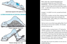Debunked: No, postural drainage is not an 'easy' way to treat Covid-19 pneumonia