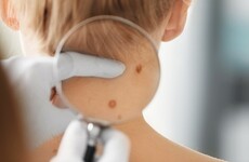 Breast, prostate, lung and skin cancer referrals drop by 25% in three months