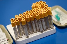 HSE launches study to test for Covid-19 antibodies in the Irish population