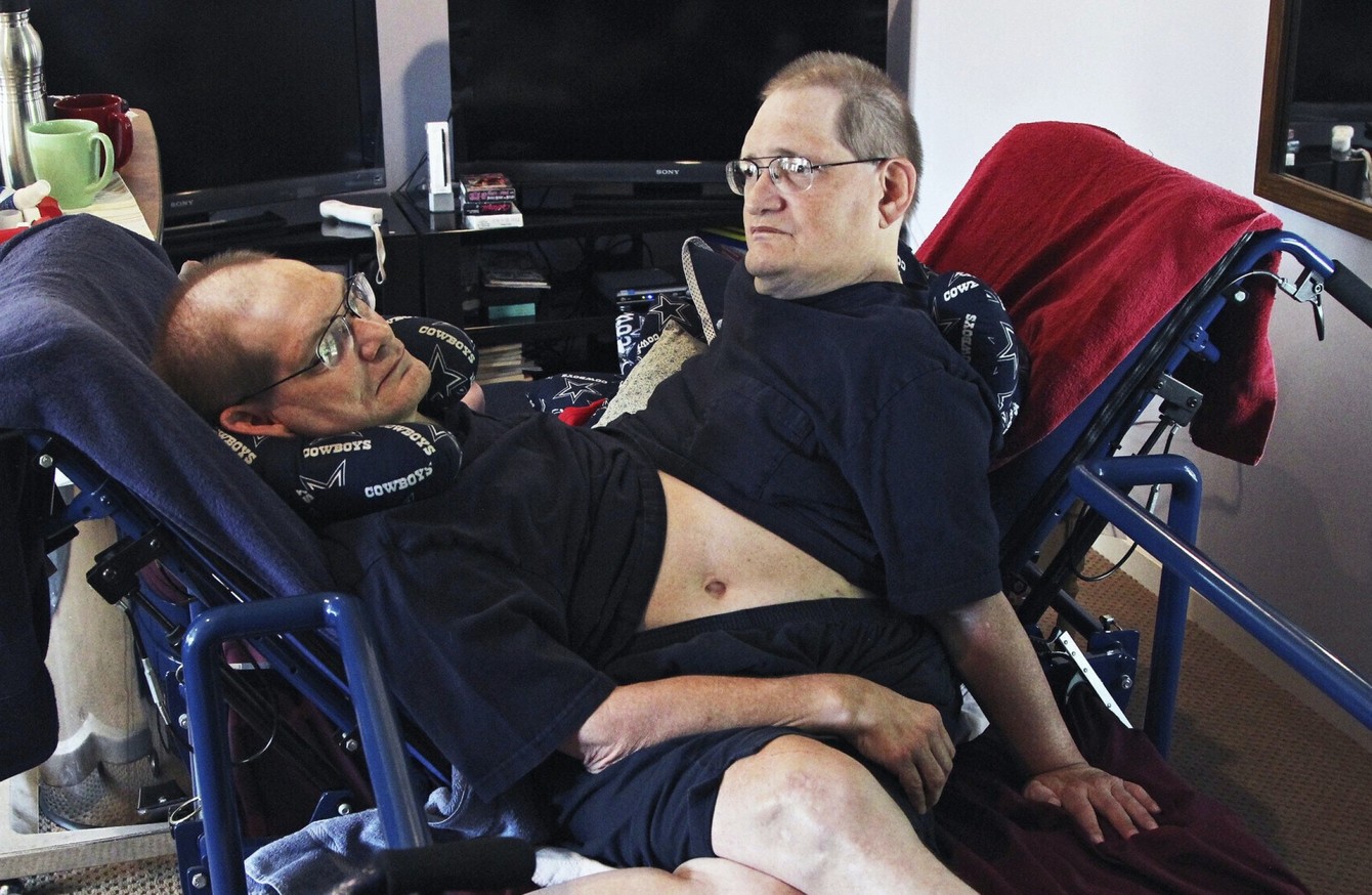 Brother Pays Tribute After Death Of World’s Longest-surviving Conjoined 