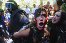 In photos: Six demonstrators hospitalised after Madrid clashes