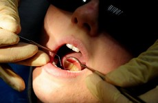 More than 260 dentists no longer providing services to medical card holders after leaving scheme