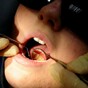More than 260 dentists no longer providing services to medical card holders after leaving scheme