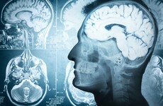 Your evening longread: What you need to know about how your brain works