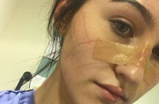 Student nurse: 'I never understood why nurses left Ireland, but now I plan to join them'