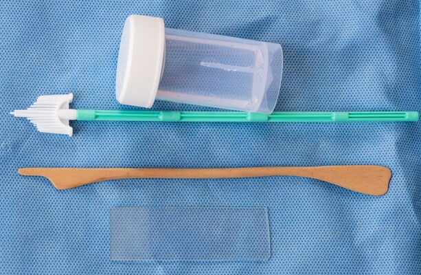 Why does CervicalCheck use the HPV test instead of checking for all smear abnormalities?