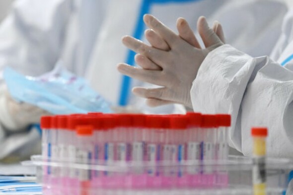 NI Department of Health rejects Taoiseach's 'wholly incorrect' comments about testing for UK variant - Vimarsana News