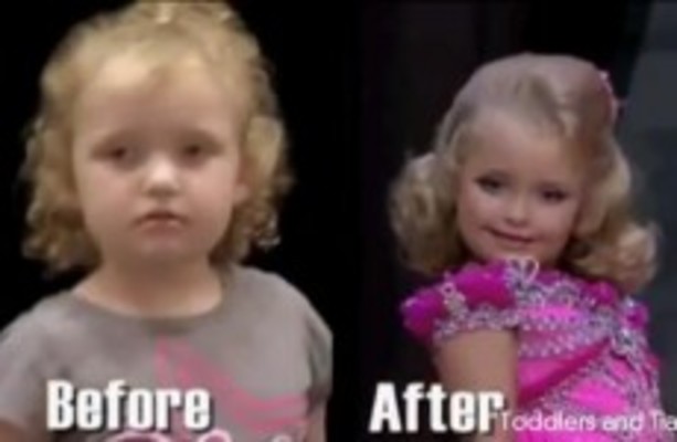 toddlers and tiaras before and after