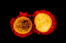 Debunked: Yes, the virus that causes Covid-19 has been isolated and photographed