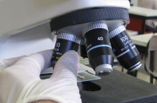 TCD study aiming to improve personalisation of ovarian cancer treatment