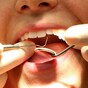 Dental treatment for medical card holders in 'complete chaos', industry body says