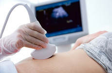 New guidance for maternity hospitals on allowing partners attend 12-week scans and C-sections
