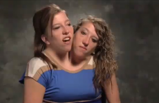 VIDEO: Conjoined twins get their own reality TV show