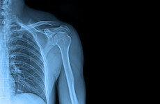 Increase in number of patients accidentally exposed to ionising radiation in hospitals