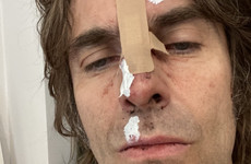Liam Gallagher cancels Belfast gig after falling out of helicopter at music festival