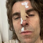 Liam Gallagher cancels Belfast gig after falling out of helicopter at music festival