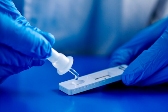 Government to send antigen tests to fully vaccinated close contacts - Vimarsana News