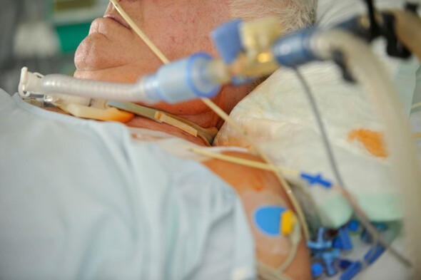 Projections of a potential ICU surge leave doctor 'concerned' - Vimarsana News