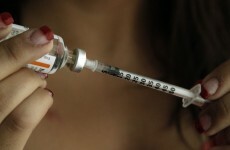 Radiotherapy may increase diabetes risk for some childhood cancer survivors