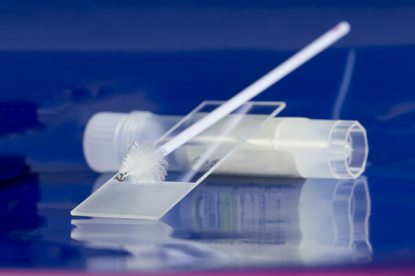 Cervical smear intervals moved from 3 to 5 years with HPV testing. Why? - Vimarsana News