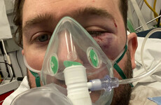 Man attacked in Dublin city says more needs to be done to tackle hate-related violence
