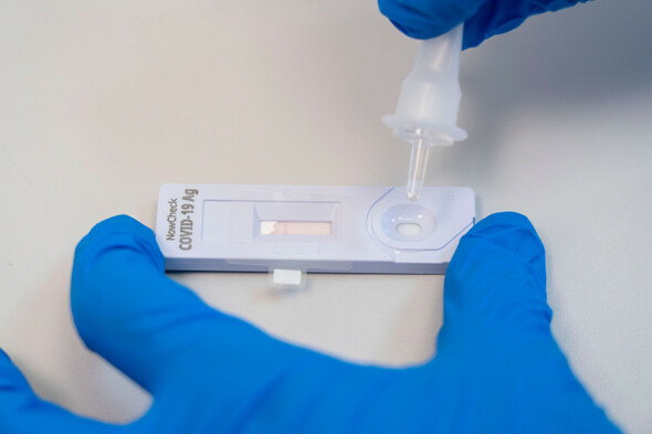 Coronavirus: 2,307 new cases and 412 patients in hospital, including 36 in ICU - Vimarsana News