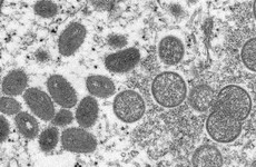 Number of monkeypox cases confirmed worldwide passes 200 milestone – EU disease agency