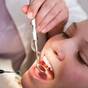 Nation's oral health at risk as children not seeing a dentist until their teens
