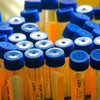 EU buys 110,000 vaccine doses against monkeypox