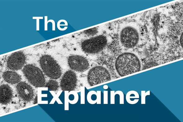 The Explainer: What's being done to stop the spread of monkeypox? - Vimarsana News