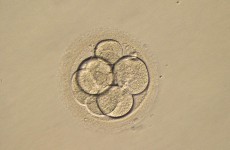 Poll: Would you support the modification of embryos to prevent genetic diseases?
