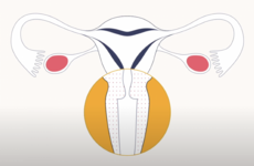 Why is it important to attend screening post menopause?