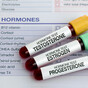 GP: What is testosterone and who can it help in menopause?
