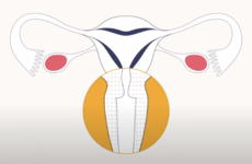Why is it important to attend screening post menopause?