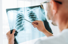 Mobile x-ray service for older people to be expanded next year in effort to reduce ED visits