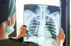 Radiographers in Galway hospitals vote for imminent industrial action