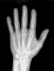 10 scientific discoveries that were complete accidents