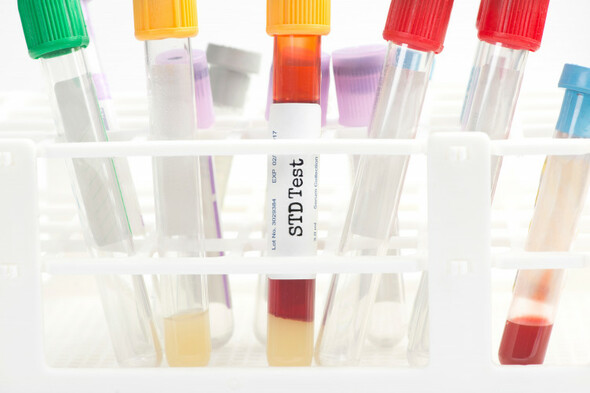 Gonorrhoea and syphilis rates in Ireland among highest in Europe amid 'concerning' rise in STIs - Vimarsana News