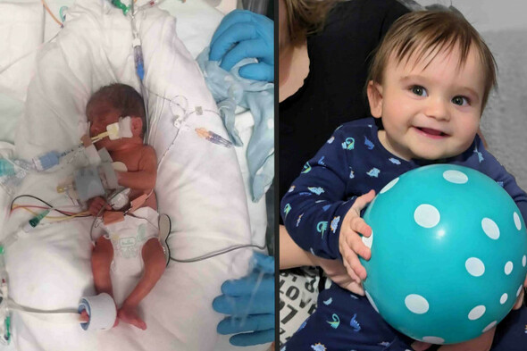 Baby born in Wales three months early and weighing just over a pound celebrates first birthday - Vimarsana News